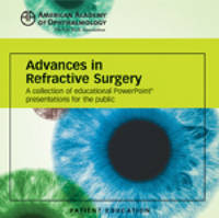 Advances in Refractive Surgery Powerpoint Presentation
