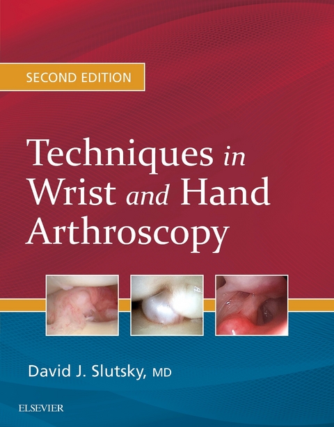 Techniques in Wrist and Hand Arthroscopy E-Book -  David J. Slutsky