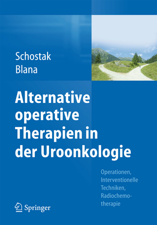 Alternative operative Therapien in der Uroonkologie