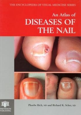 An Atlas of Diseases of the Nail