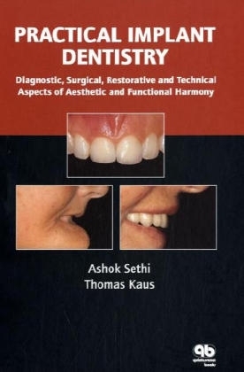 Practical Implant Dentistry - Ashok Sethi, Thomas Kaus