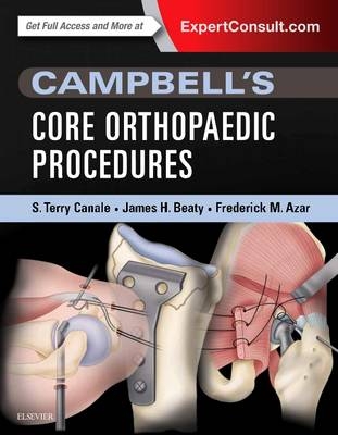Campbell's Core Orthopaedic Procedures - S. Terry Canale, James H. Beaty, Frederick M. Azar