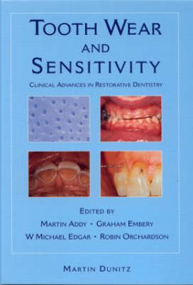 Tooth Wear and Sensitivity - 