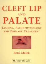 Cleft Lip and Palate - Ren&eacute; Malek