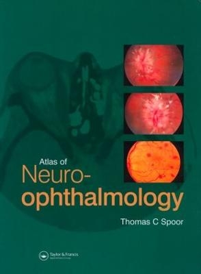 Atlas of Neuro-ophthalmology - Thomas C. Spoor