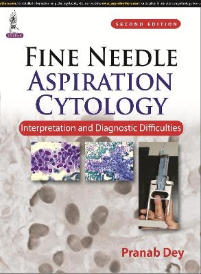 Fine Needle Aspiration Cytology: Interpretation and Diagnostic Difficulties