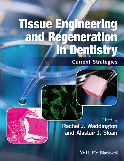 Tissue Engineering and Regeneration in Dentistry - 