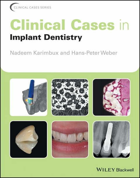 Clinical Cases in Implant Dentistry - 