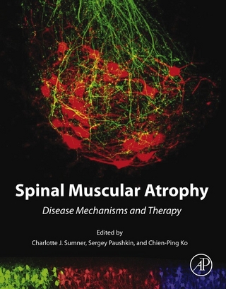 Spinal Muscular Atrophy