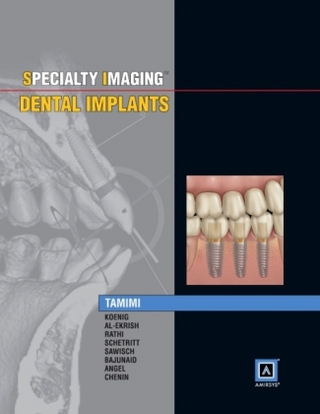 Specialty Imaging: Dental Implants