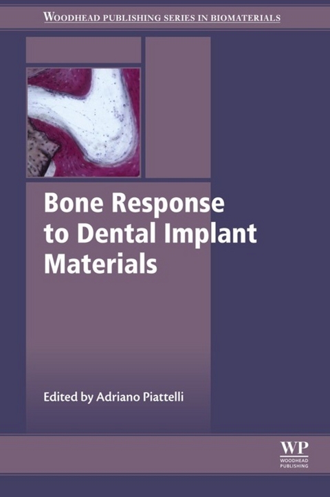 Bone Response to Dental Implant Materials - 