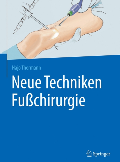 Neue Techniken Fu&szlig;chirurgie - Hajo Thermann