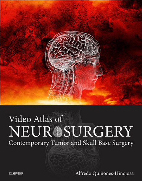 Video Atlas of Neurosurgery E-Book -  Alfredo Quinones-Hinojosa