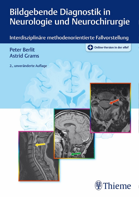 Bildgebende Diagnostik in Neurologie und Neurochirurgie - Peter-Dirk Berlit, Astrid E. Grams