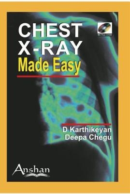 Chest X-Ray Made Easy