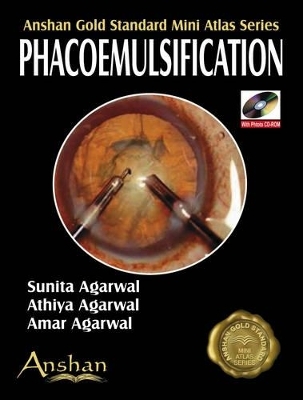 Mini Atlas of Phacoemulsification
