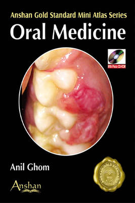 Mini Atlas of Oral Medicine