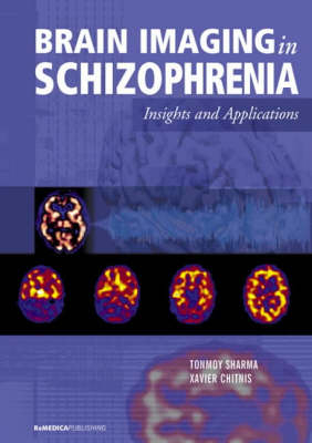 Brain Imaging in Schizophrenia - Tonmoy Sharma, Xavier Chitnis