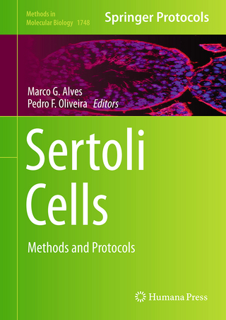 Sertoli Cells
