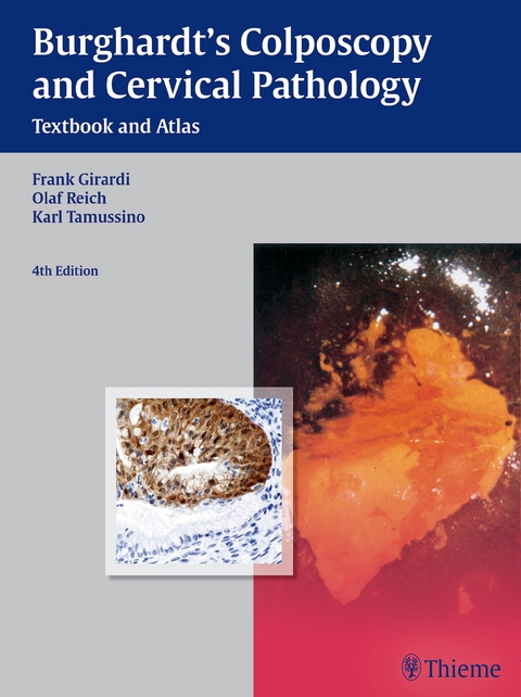 Burghardt's Colposcopy and Cervical Pathology - Frank Girardi, Olaf Reich, Karl Tamussino