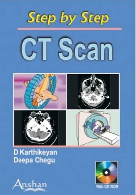CT Scan