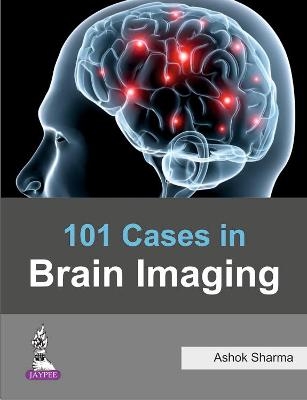 101 Cases in Brain Imaging - Ashok Sharma