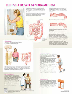 Irritable Bowel Syndrome Chart - Frank H. Netter