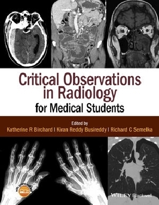 Critical Observations in Radiology for Medical Students - Katherine R. Birchard, Kiran Reddy Busireddy, Richard C. Semelka
