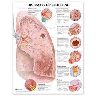 Diseases of the Lung