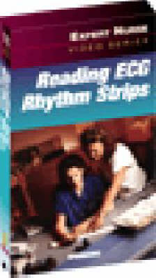 Reading ECG Rhythm Strips