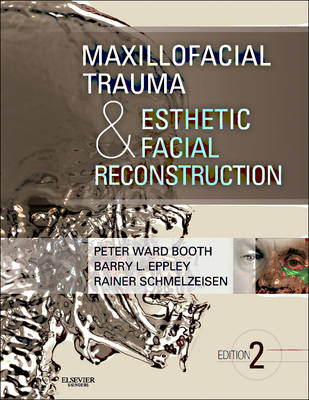 Maxillofacial Trauma and Esthetic Facial Reconstruction - E-Book