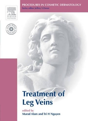 Treatment of Leg Veins