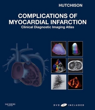 Complications of Myocardial Infarction