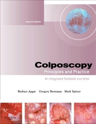 Colposcopy - Barbara S. Apgar, Gregory L. Brotzman, Mark Spitzer