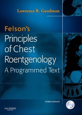 Felson's Principles of Chest Roentgenology