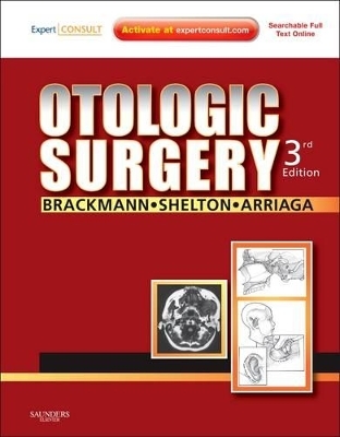 Otologic Surgery