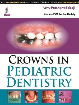 Crowns in Pediatric Dentistry