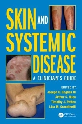 Skin and Systemic Disease - Joseph C. English III, Timothy J. Patton