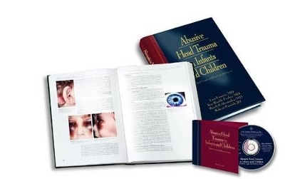 Abusive Head Trauma in Infants and Children - Lori Frasier, Kay Rauth-Farley, Randell Alexander, Robert Parrish, J.C.Upshaw Downs