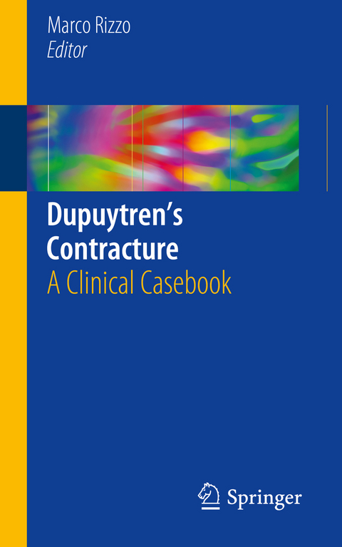 Dupuytren&rsquo;s Contracture - 