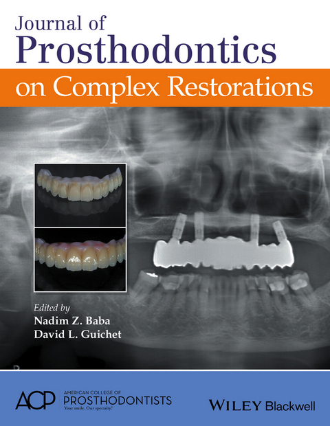 Journal of Prosthodontics on Complex Restorations - 