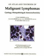 Malignant Lymphomas