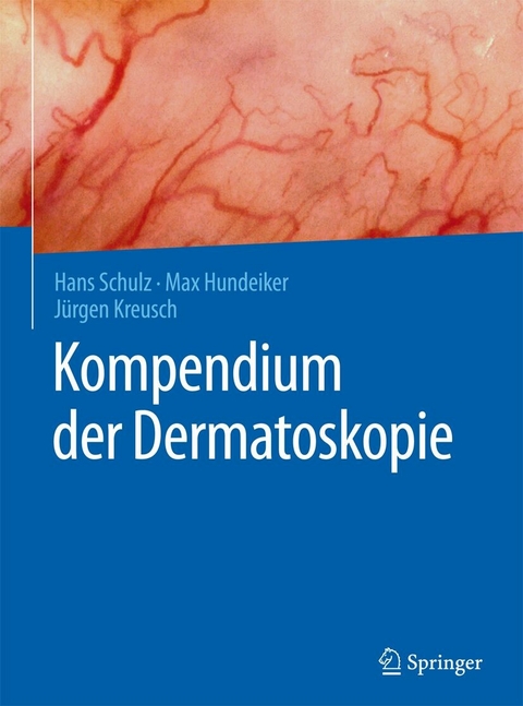 Kompendium der Dermatoskopie -  Hans Schulz,  Max Hundeiker,  Jürgen Kreusch