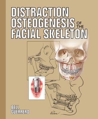 Distraction Osteogenesis of the Facial Skeleton - William Bell, Cesar Guerrero
