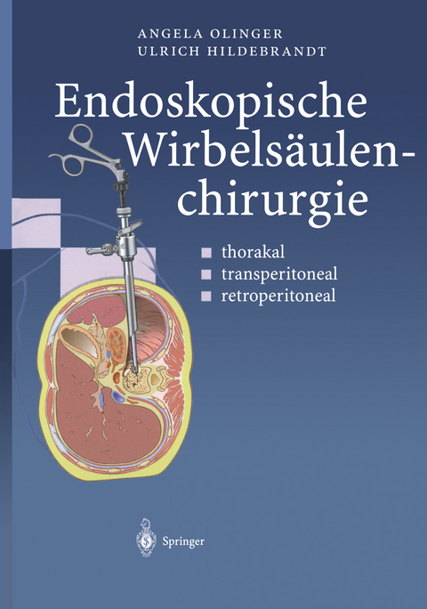 Endoskopische Wirbels&auml;ulenchirurgie - Angela Olinger, Ulrich Hildebrandt