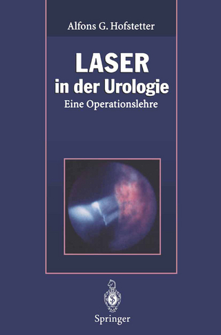 Laser in der Urologie