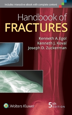 Handbook of Fractures - 