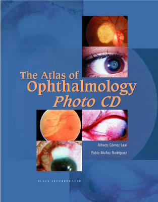 The Atlas of Ophthalmology Photo CD