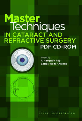 Master Techniques in Cataract and Refractive Surgery
