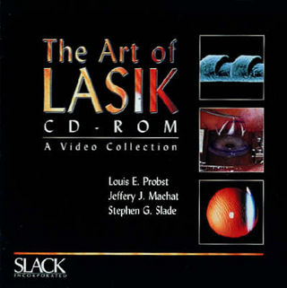The Art of LASIK